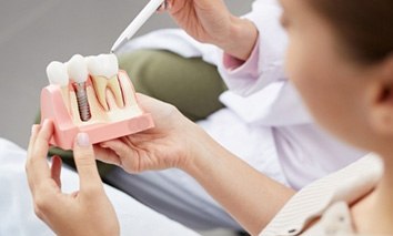 Dentist showing a dental implant model to a patient