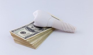 Dental implant on stack of cash